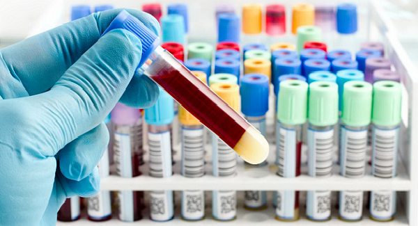 Image of blood in a test sample tube.