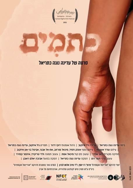עדינה0 כתמים