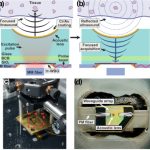 High-resolution silicon photonics focused ultrasound transducer with a sub-millimeter aperture.