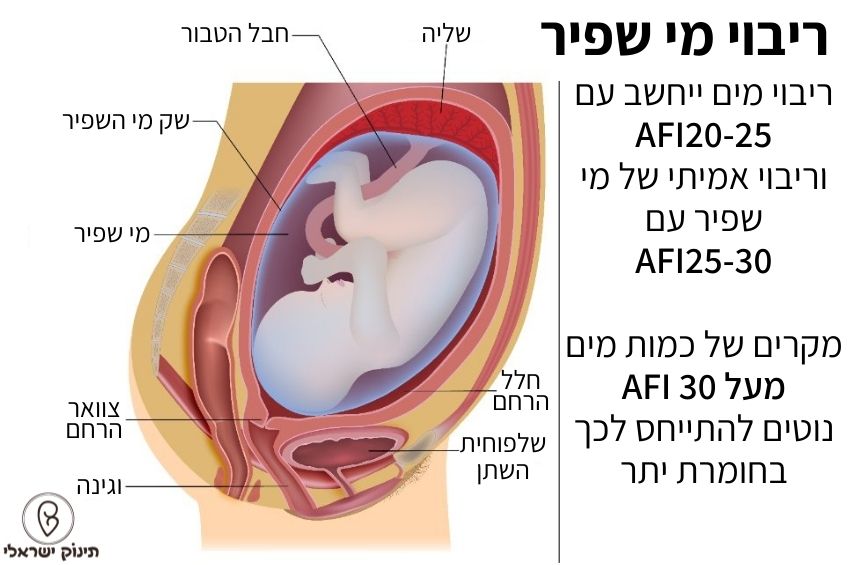 ריבוי מי שפיר ריבוי מי שפיר