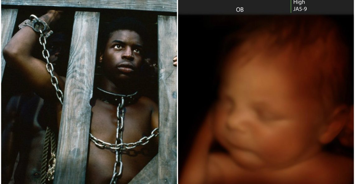 The Fetal Solution: Victims of American Hedonism Counted in Millions of Unborn